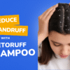 Understanding Dandruff and Scalp Itching: Causes, Symptoms, and Solutions