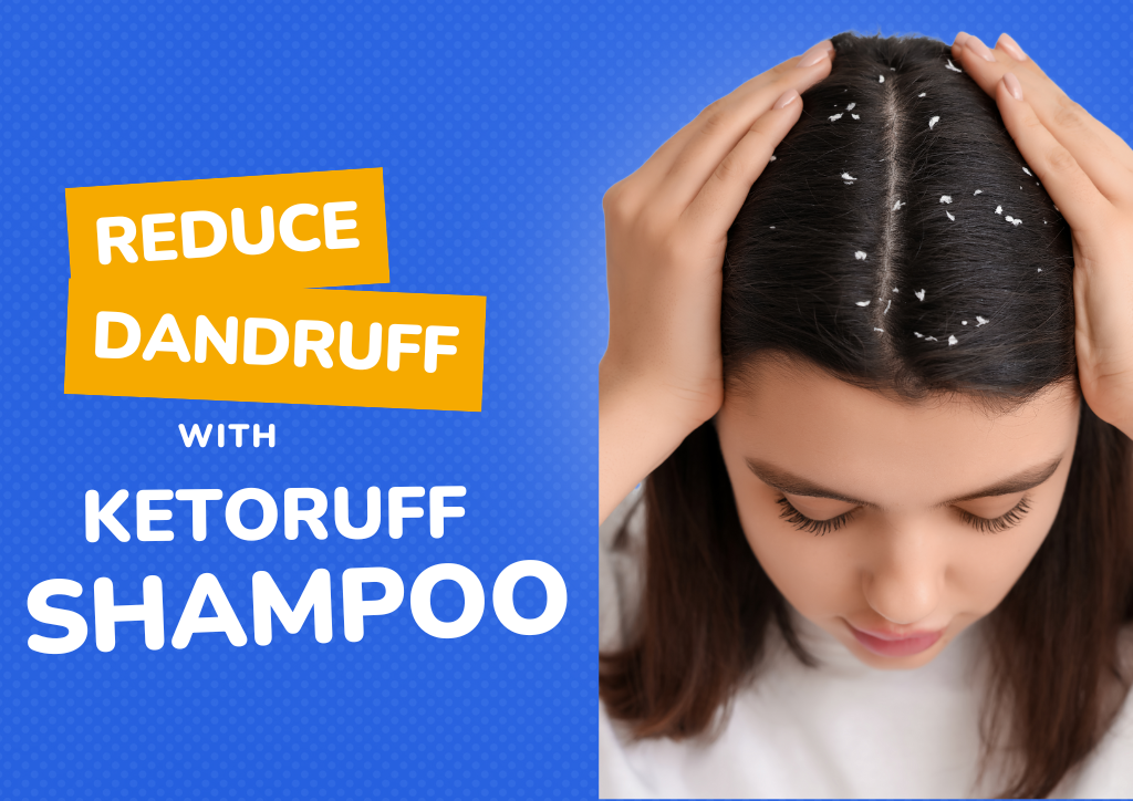 Understanding Dandruff and Scalp Itching: Causes, Symptoms, and Solutions